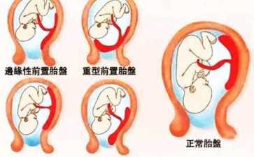 揭秘试管婴儿助孕全程时间